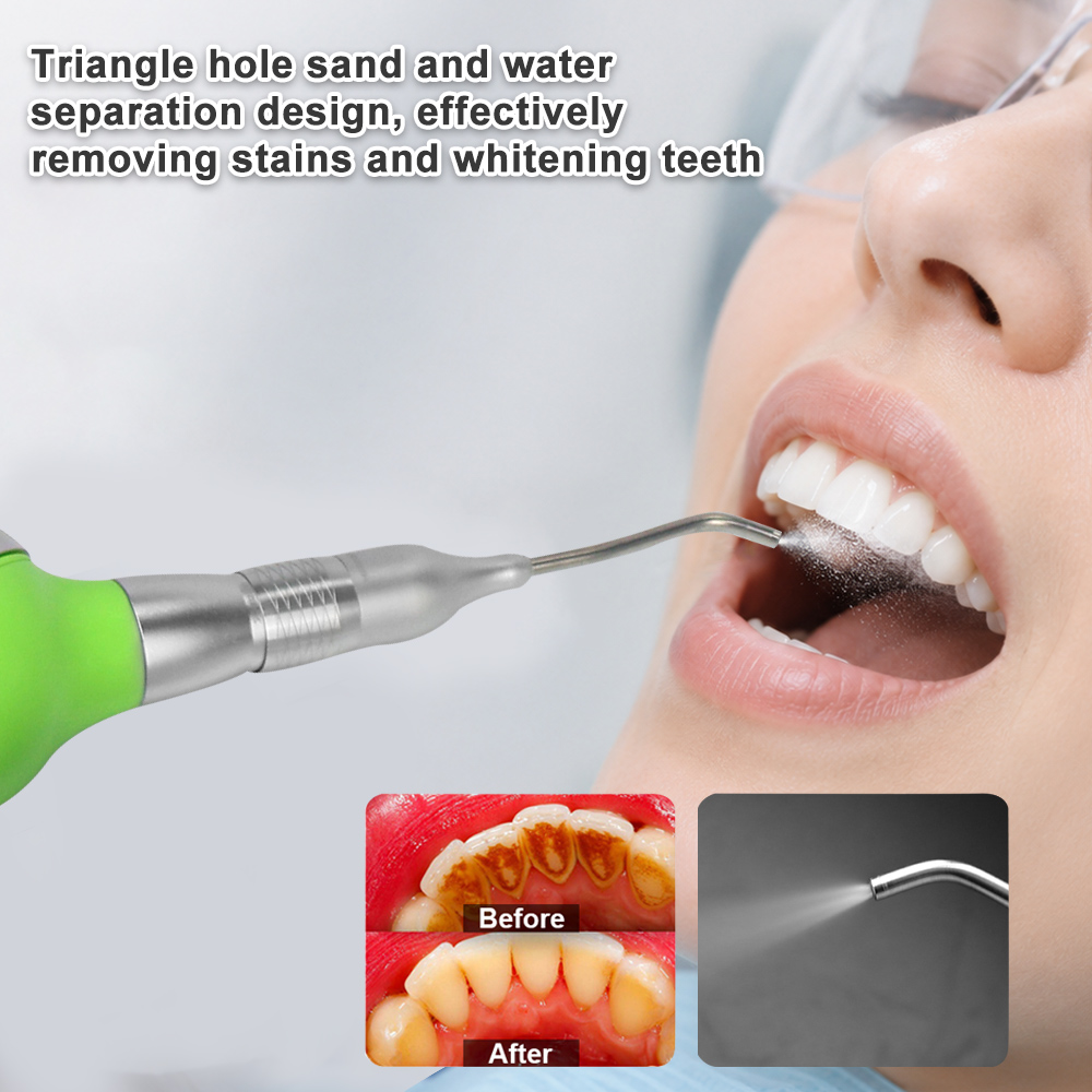 Dental Air Polisher With Anti- - Teeth Whitening Options 评论和价格