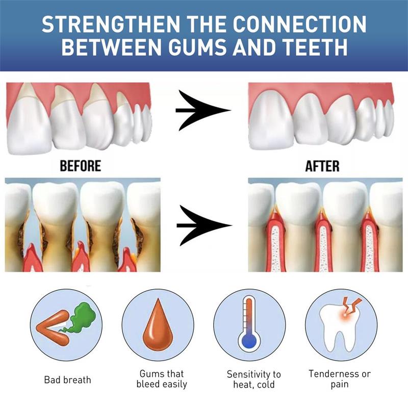 Gum Repair Care Serum Relieve  - Teeth Whitening Gingival Barrier 评论和价格