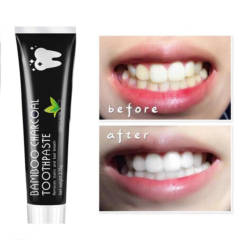 Teeth Whitening Activated Char - Teeth Whitening Naturally 评论和价格